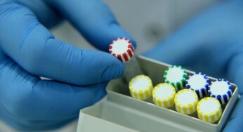 Turkish doctor develops urine kit to detect COVID-19